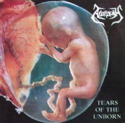 Apoplexy (SVK) : Tears of the Unborn